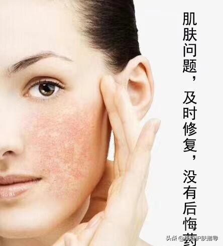 哪个牌子的祛斑产品最有效果